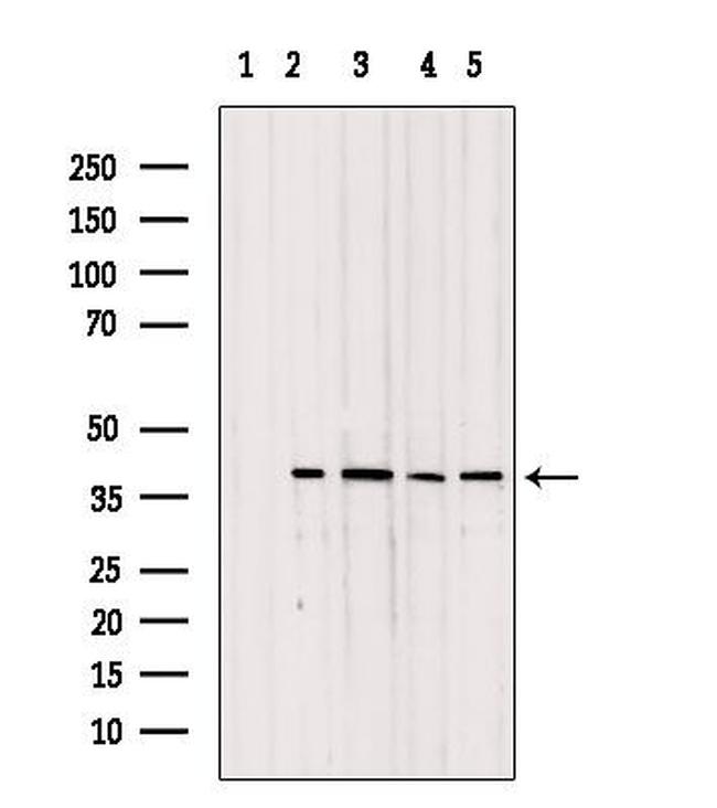 TOMM40 Antibody in Western Blot (WB)