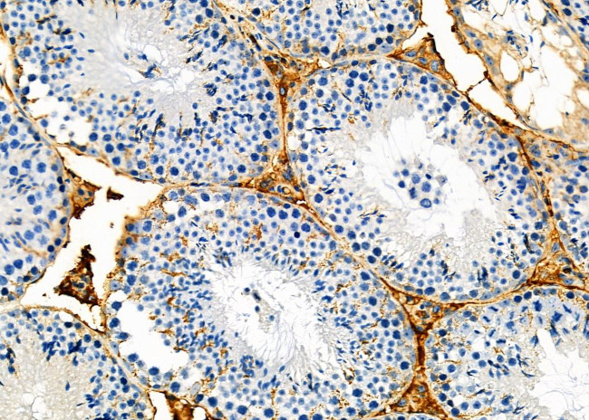 Activin A Antibody in Immunohistochemistry (Paraffin) (IHC (P))