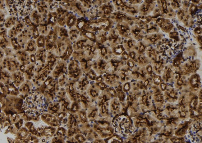 MGRN1 Antibody in Immunohistochemistry (Paraffin) (IHC (P))