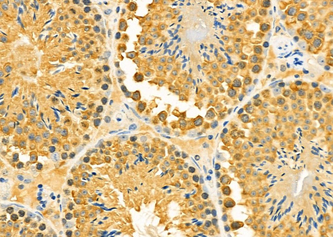 MGRN1 Antibody in Immunohistochemistry (Paraffin) (IHC (P))