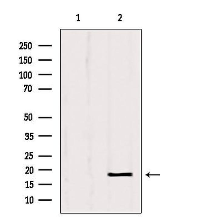 SRP14 Antibody in Western Blot (WB)