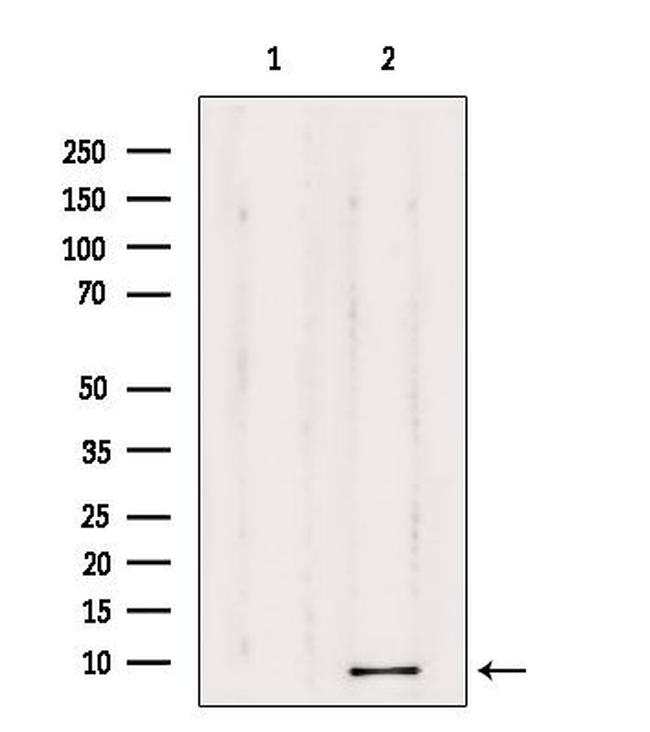 TMSB4X Antibody in Western Blot (WB)
