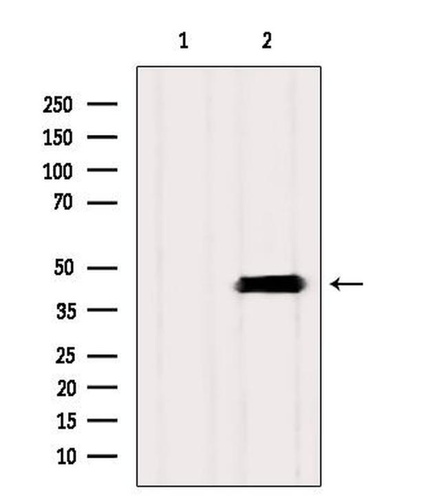 SLC10A2 Antibody in Western Blot (WB)