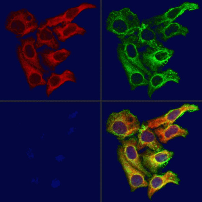 DIO1 Antibody in Immunocytochemistry (ICC/IF)