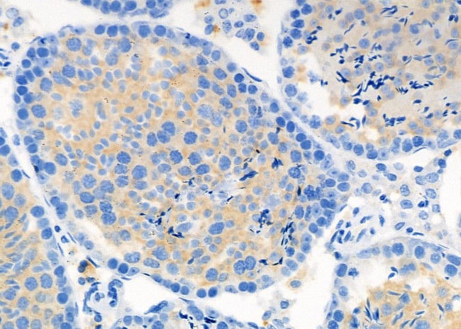 DIO1 Antibody in Immunohistochemistry (Paraffin) (IHC (P))