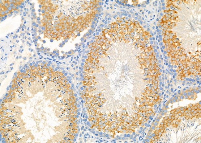 DIO1 Antibody in Immunohistochemistry (Paraffin) (IHC (P))