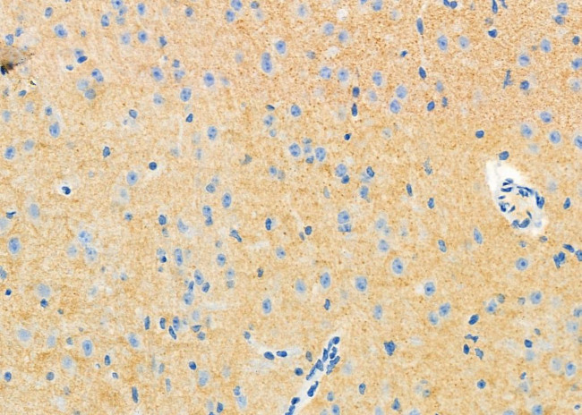 Drebrin Antibody in Immunohistochemistry (Paraffin) (IHC (P))