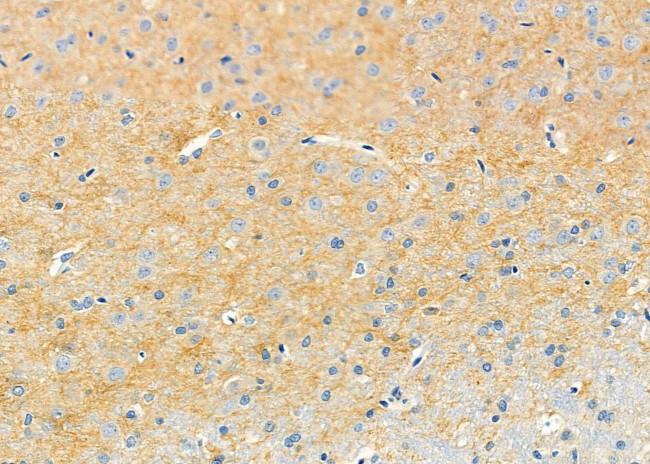 Drebrin Antibody in Immunohistochemistry (Paraffin) (IHC (P))