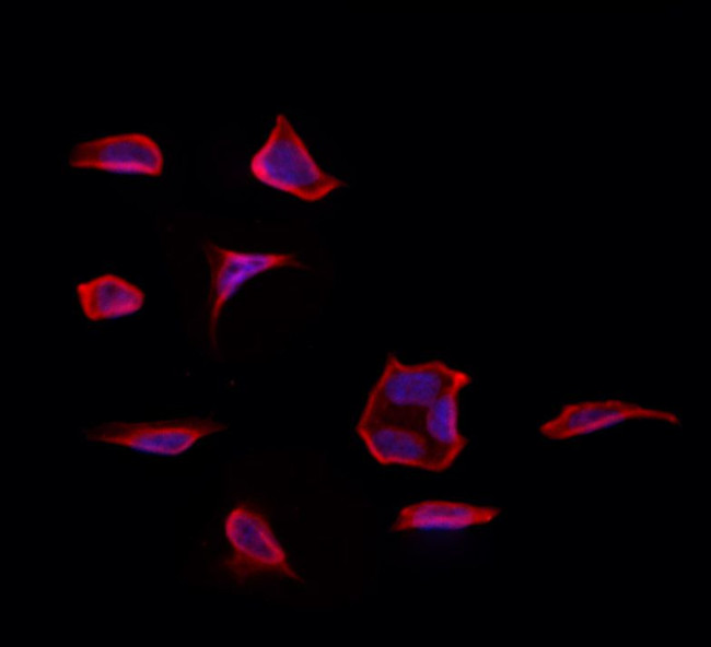 Drebrin Antibody in Immunocytochemistry (ICC/IF)