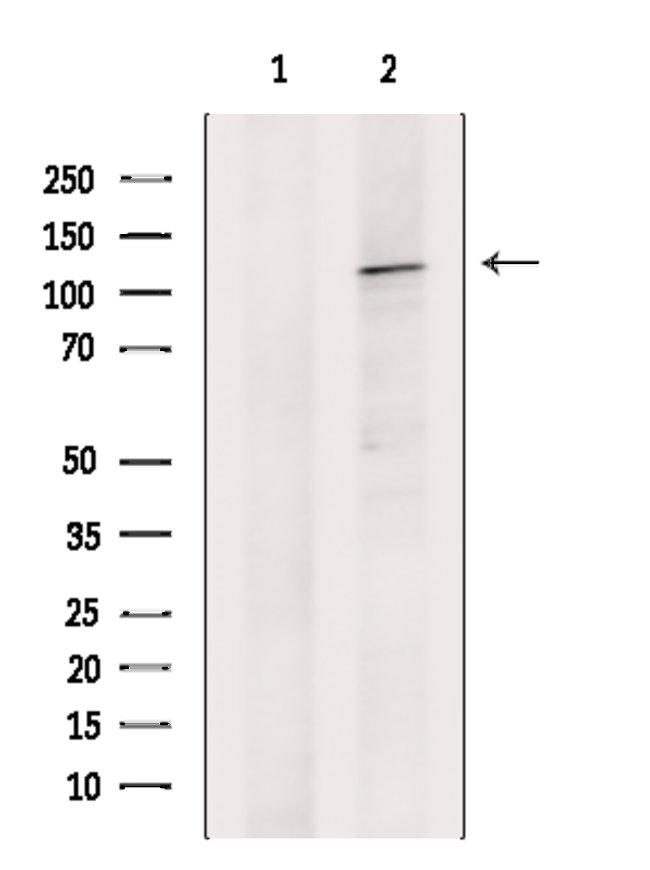 Drebrin Antibody in Western Blot (WB)