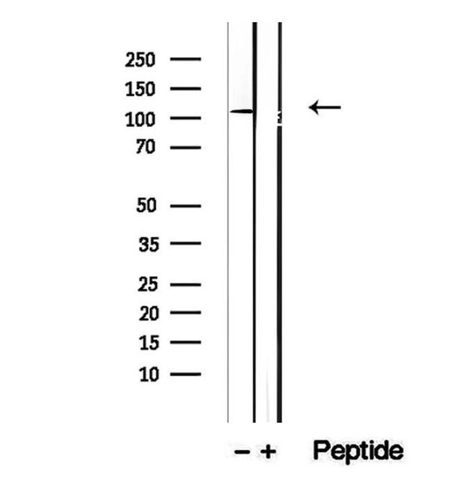 Drebrin Antibody in Western Blot (WB)