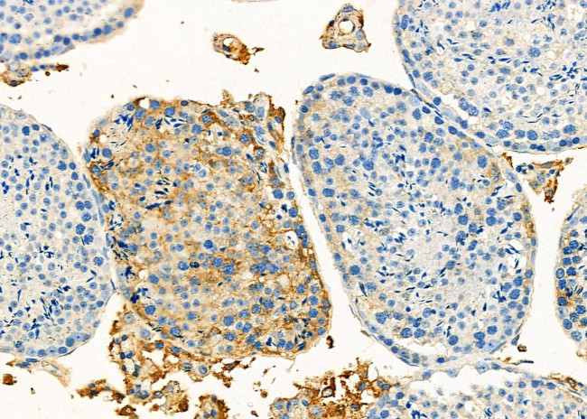 SLC39A6 Antibody in Immunohistochemistry (Paraffin) (IHC (P))