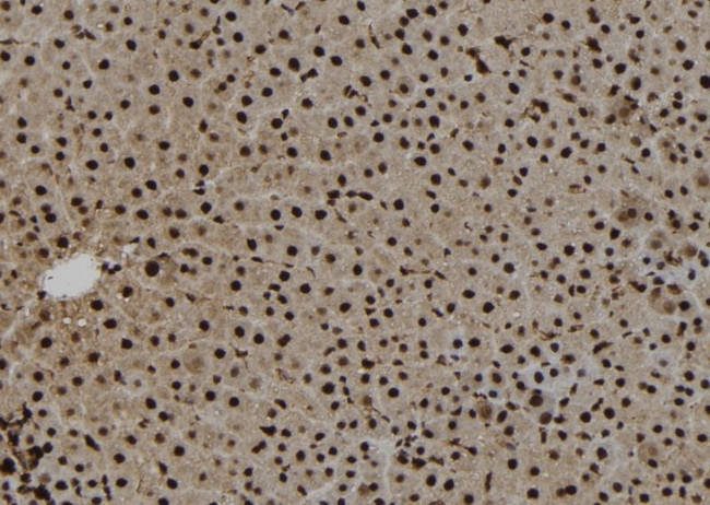 NAT10 Antibody in Immunohistochemistry (Paraffin) (IHC (P))