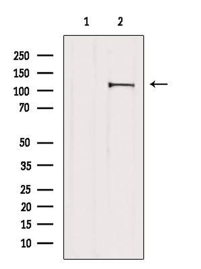 NAT10 Antibody in Western Blot (WB)