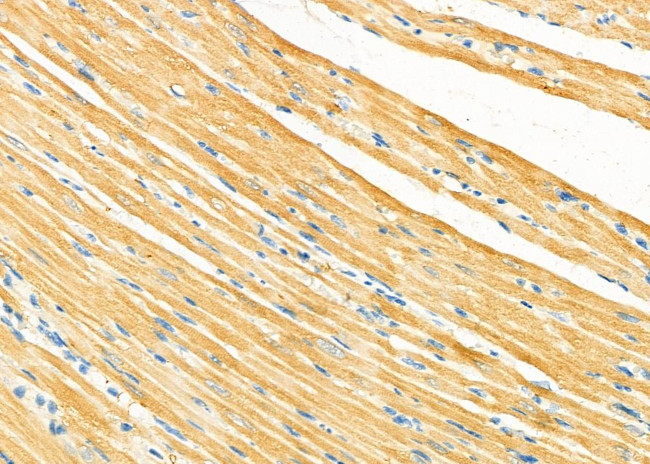 OPHN1 Antibody in Immunohistochemistry (Paraffin) (IHC (P))