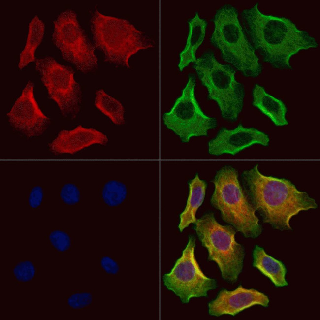 PAFAH2 Antibody in Immunocytochemistry (ICC/IF)