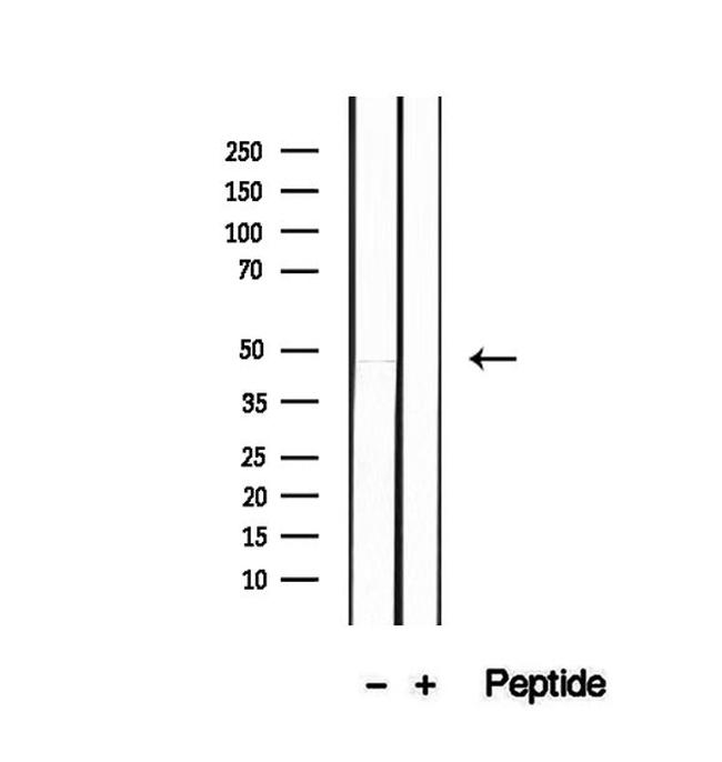 PAFAH2 Antibody in Western Blot (WB)