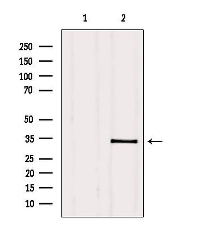 PMM2 Antibody in Western Blot (WB)