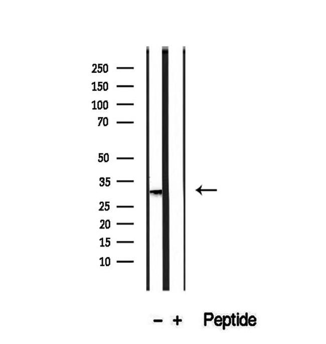 PMM2 Antibody in Western Blot (WB)