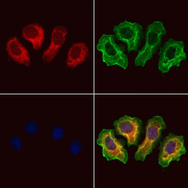 CRALBP Antibody in Immunocytochemistry (ICC/IF)