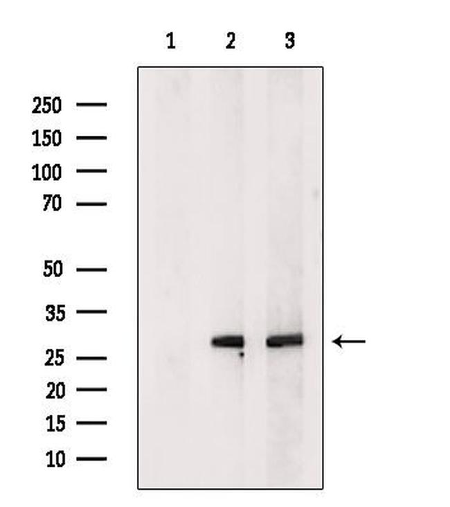 C19orf52 Antibody in Western Blot (WB)