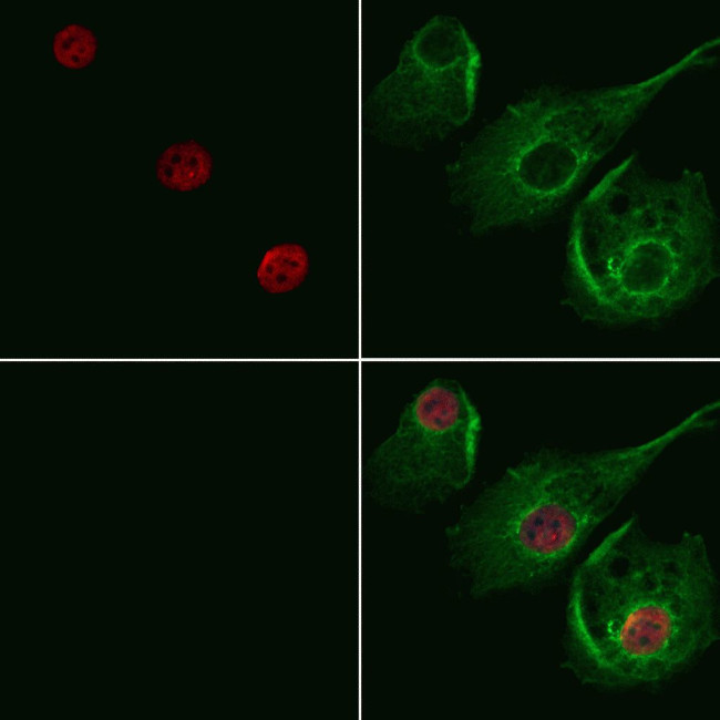 CNOT3 Antibody in Immunocytochemistry (ICC/IF)