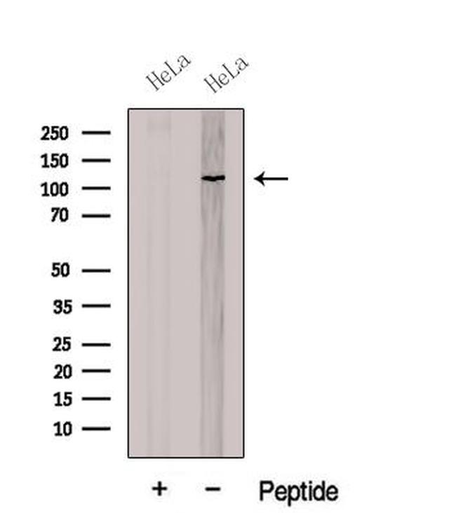 CNOT3 Antibody in Western Blot (WB)