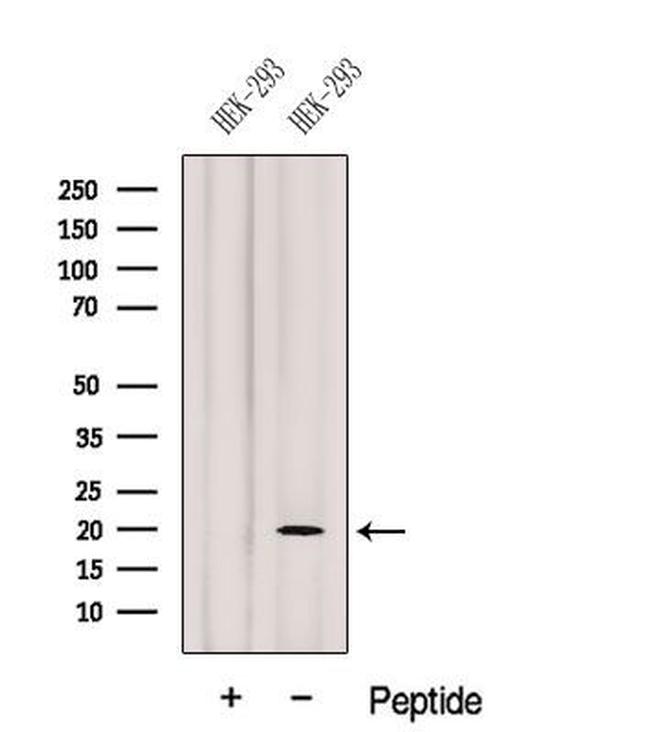 Gemin 6 Antibody in Western Blot (WB)