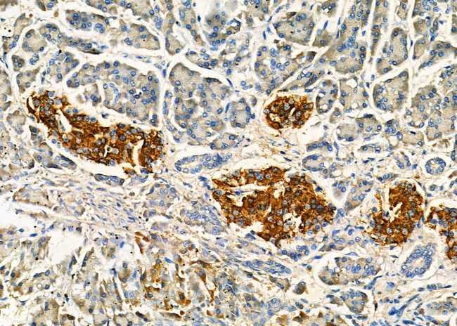 IMPDH1 Antibody in Immunohistochemistry (Paraffin) (IHC (P))