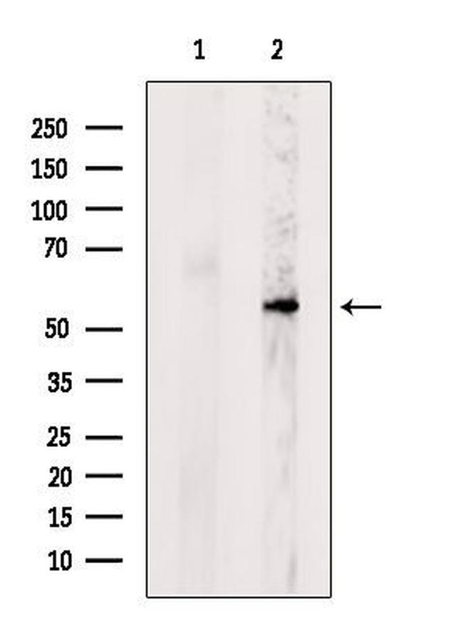 POMGNT1 Antibody in Western Blot (WB)