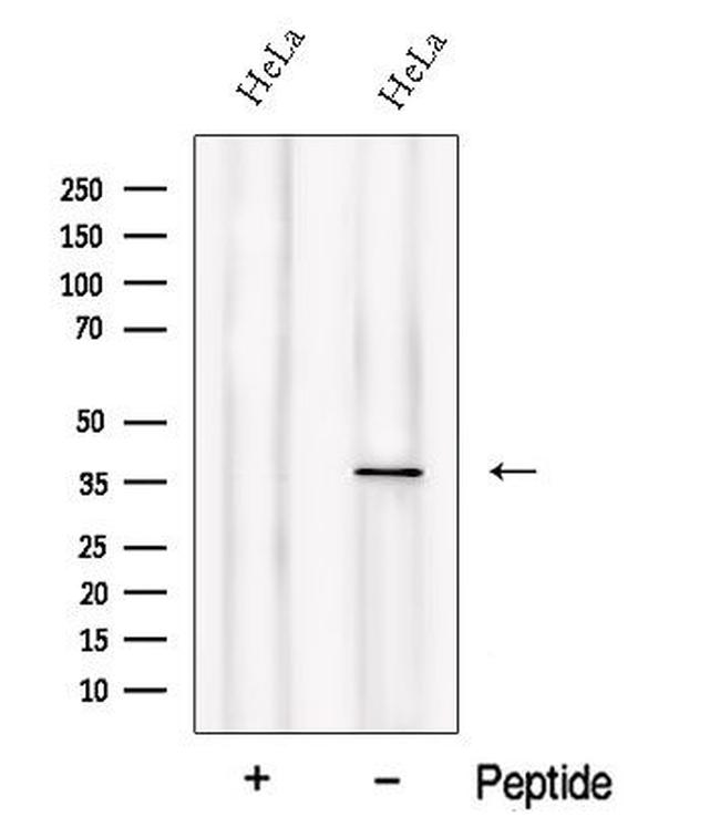 PIH1D1 Antibody in Western Blot (WB)