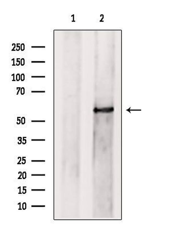 PRPF4 Antibody in Western Blot (WB)