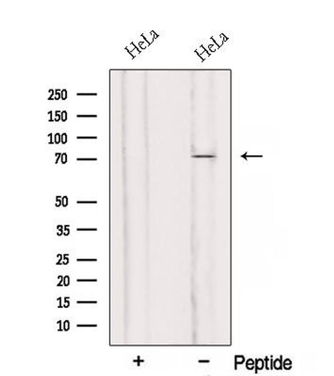 RMI1 Antibody in Western Blot (WB)