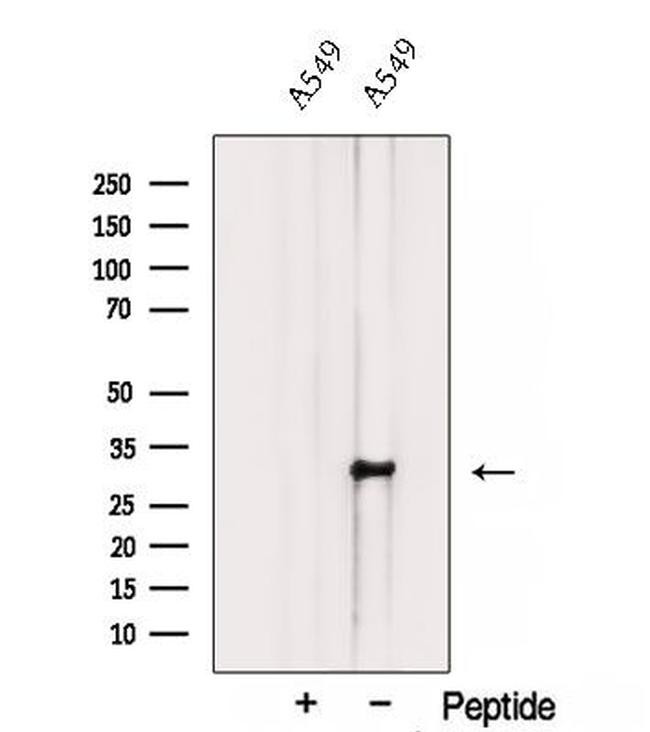TMEM106B Antibody in Western Blot (WB)