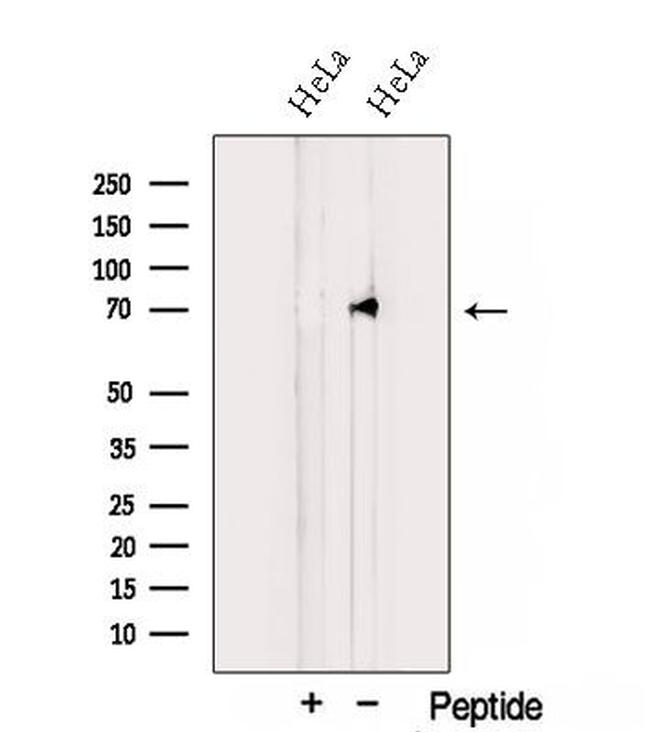 TNIP1 Antibody in Western Blot (WB)