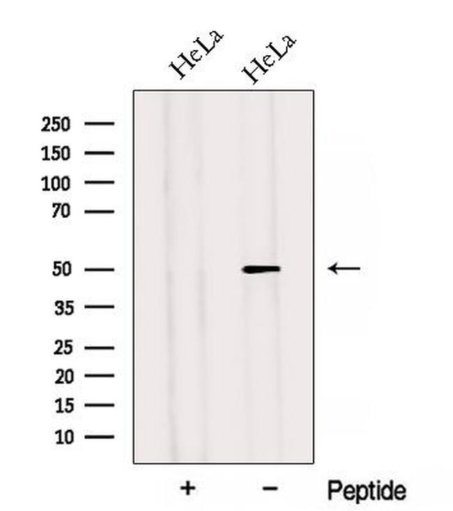 Adiponectin Receptor 2 Antibody in Western Blot (WB)