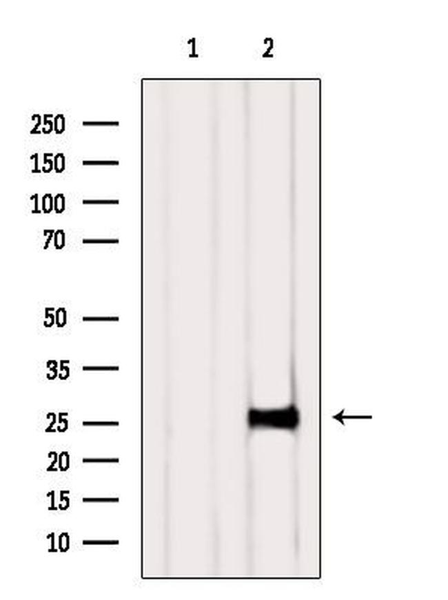 NAA11 Antibody in Western Blot (WB)