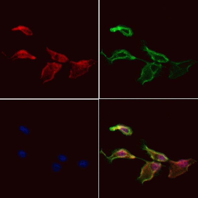 NRDE2 Antibody in Immunocytochemistry (ICC/IF)