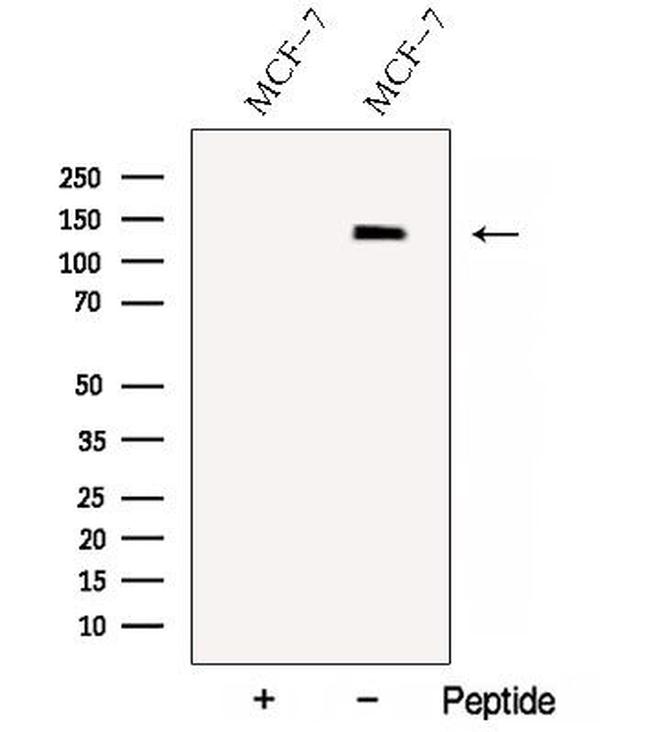 NRDE2 Antibody in Western Blot (WB)