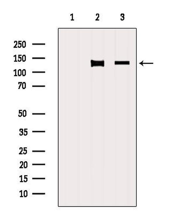 NRDE2 Antibody in Western Blot (WB)