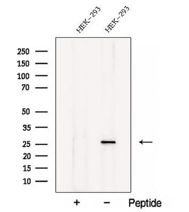 MALSU1 Antibody in Western Blot (WB)