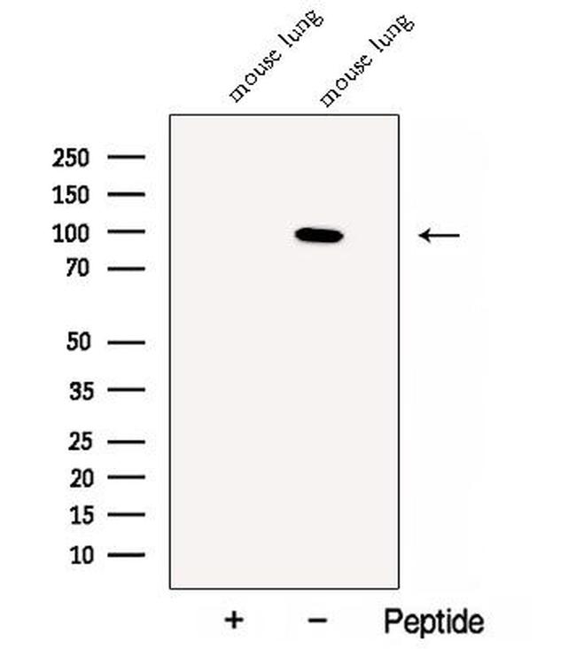 CLGN Antibody in Western Blot (WB)