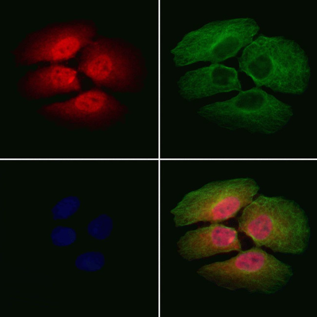 CHMP1A Antibody in Immunocytochemistry (ICC/IF)