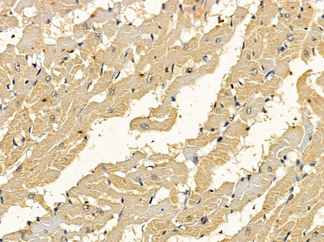 DOCK8 Antibody in Immunohistochemistry (Paraffin) (IHC (P))