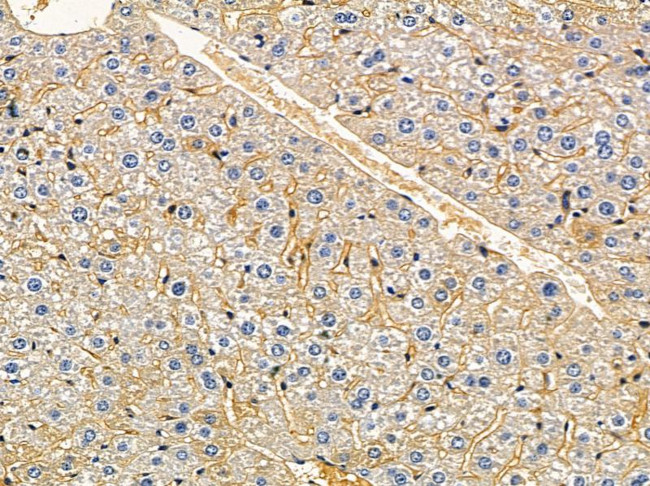 FA2H Antibody in Immunohistochemistry (Paraffin) (IHC (P))