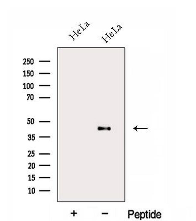 FA2H Antibody in Western Blot (WB)