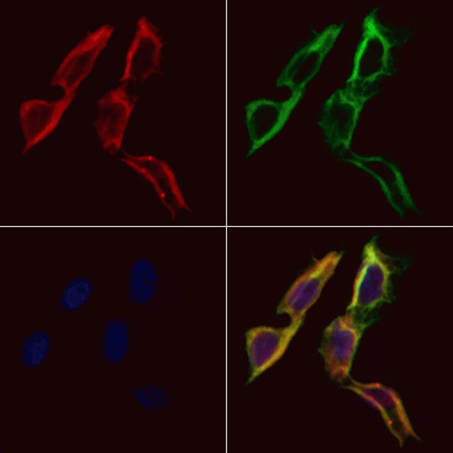 FAM134B Antibody in Immunocytochemistry (ICC/IF)