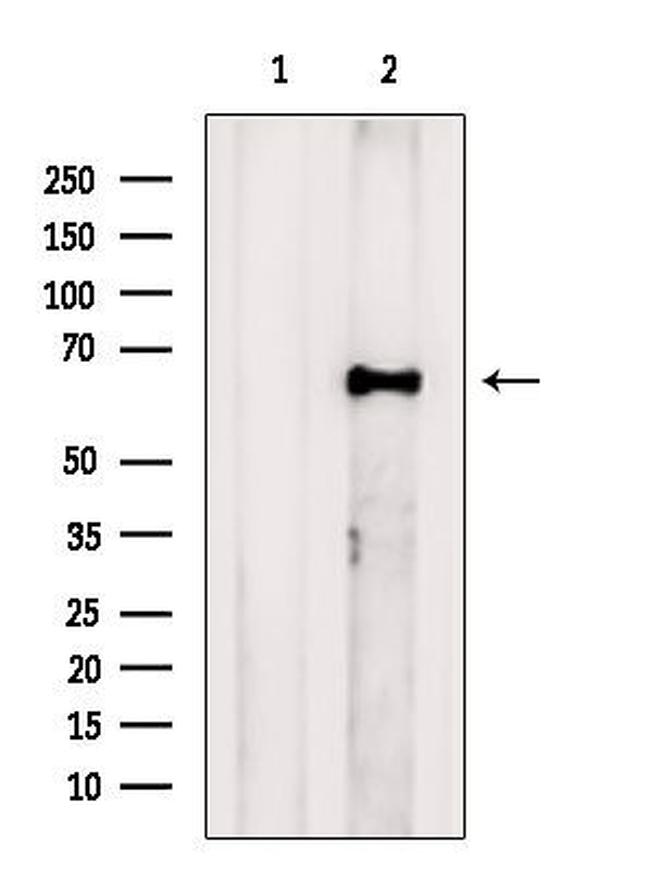 FAM134B Antibody in Western Blot (WB)