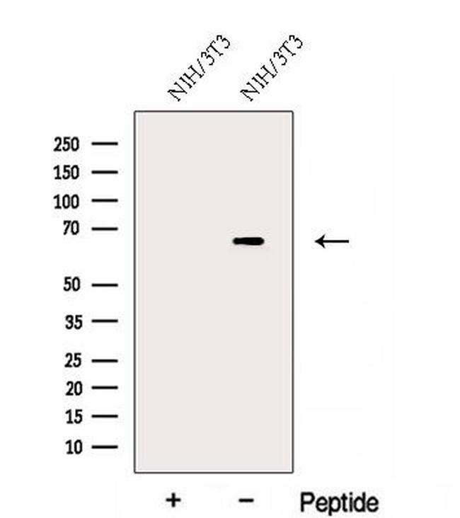 FAM134B Antibody in Western Blot (WB)