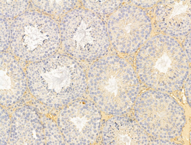 FBLIM1 Antibody in Immunohistochemistry (Paraffin) (IHC (P))